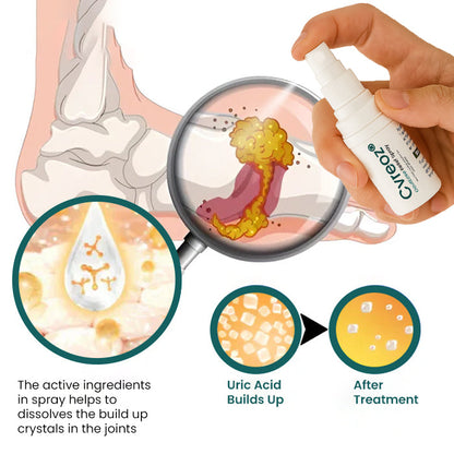 🔥The FDA-Approved Solution🌟 Official Store | Cvreoz® GoutEase Relief Spray