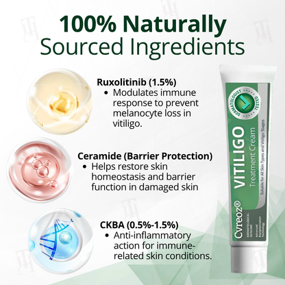 Cvreoz® Vitiligo Treatment Cream