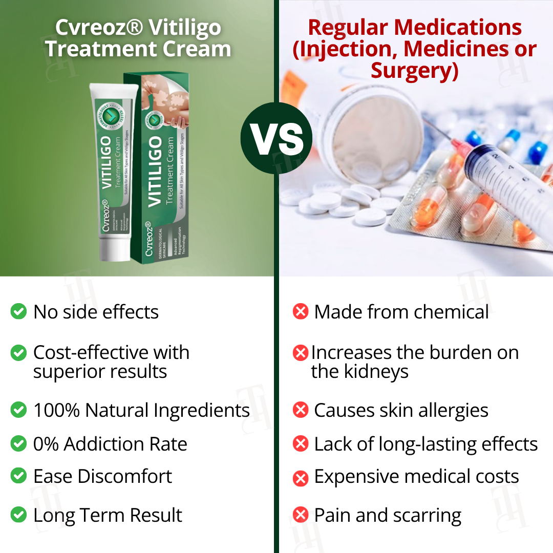 Cvreoz® Vitiligo Treatment Cream