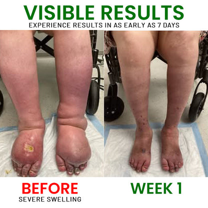 🌟 Official Store |AEXZR® FluidEase Leg Therapy Cream