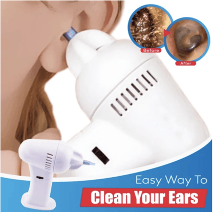 RZXEA™  Ear Wax Easy Remover