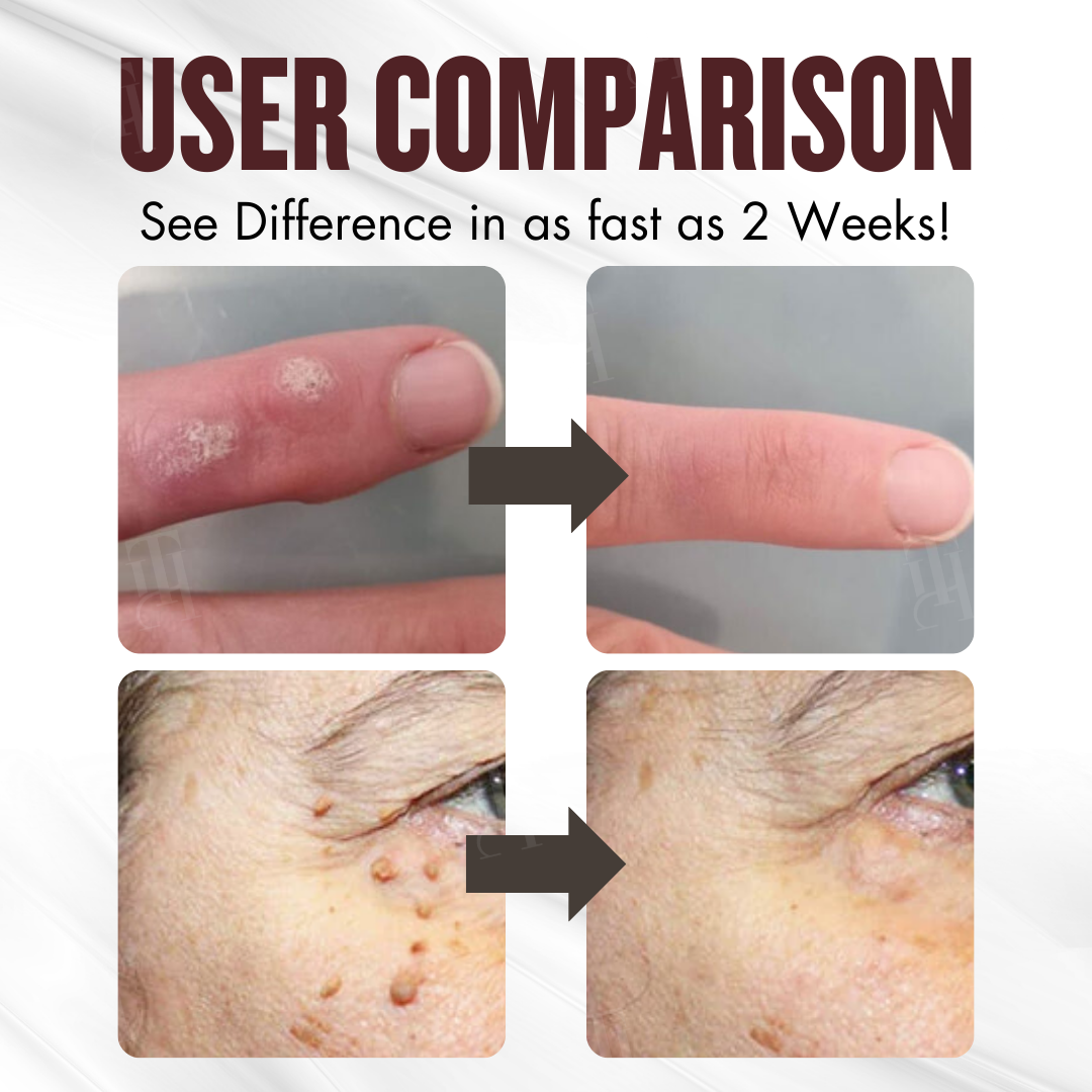 🌟 Official Store | Cvreoz® All-in-1 Ceramide Skin Cream