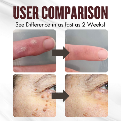 🌟 Official Store | Cvreoz® All-in-1 Ceramide Skin Cream