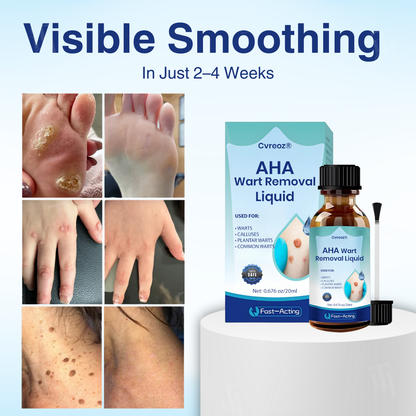 🌟 Official Store | Cvreoz® AHA Wart Removal Liquid
