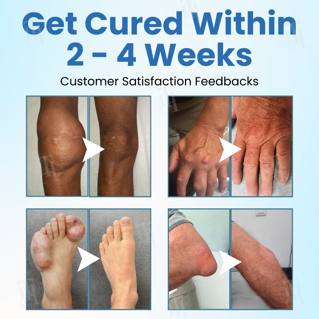 🔥The FDA-Approved Solution🌟 Official Store | Croaie® EnduraHeal Magnesium Pain Relief Cream