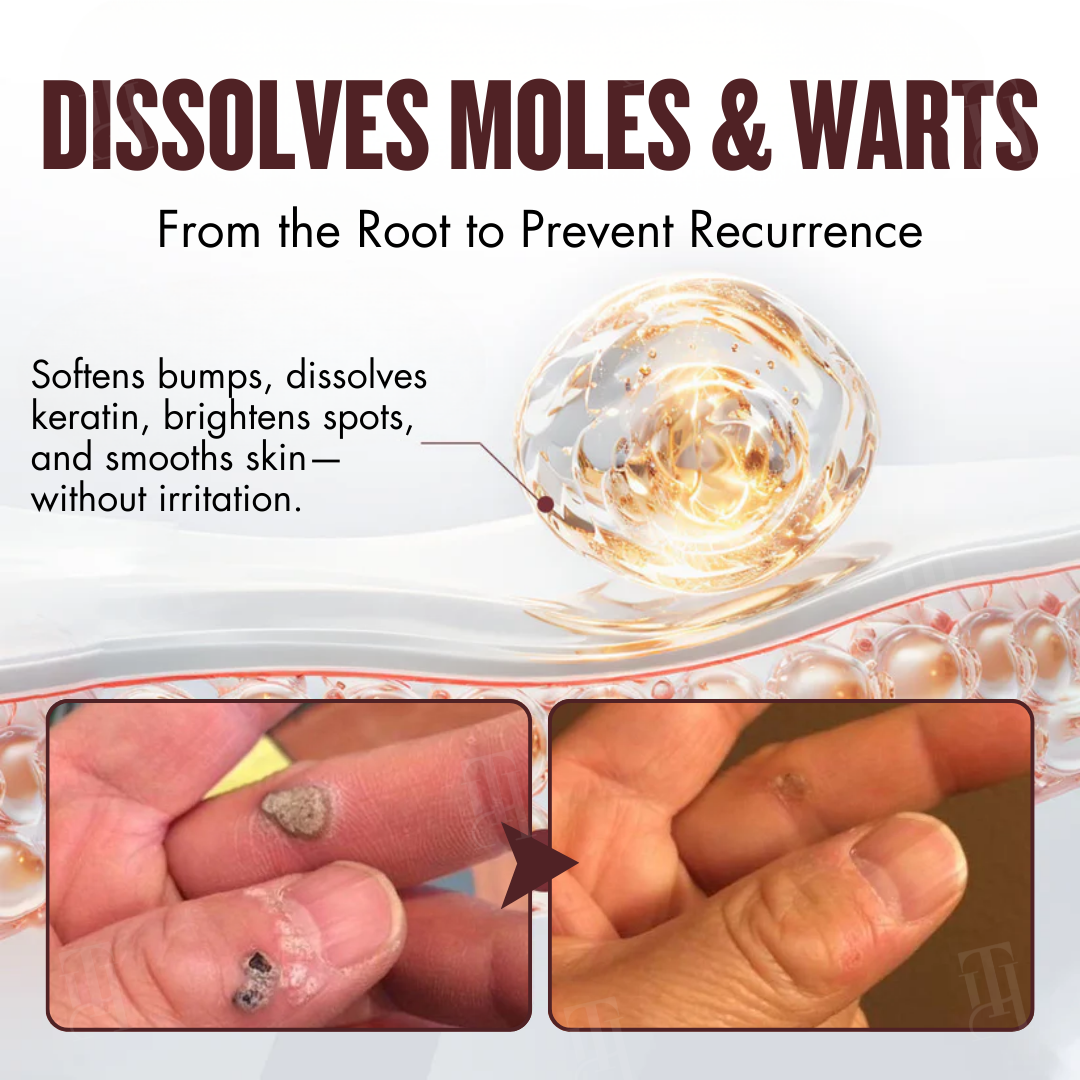 🌟 Official Store | Cvreoz® All-in-1 Ceramide Skin Cream