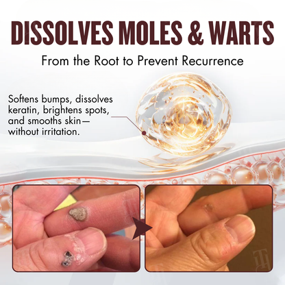 🌟 Official Store | Cvreoz® All-in-1 Ceramide Skin Cream