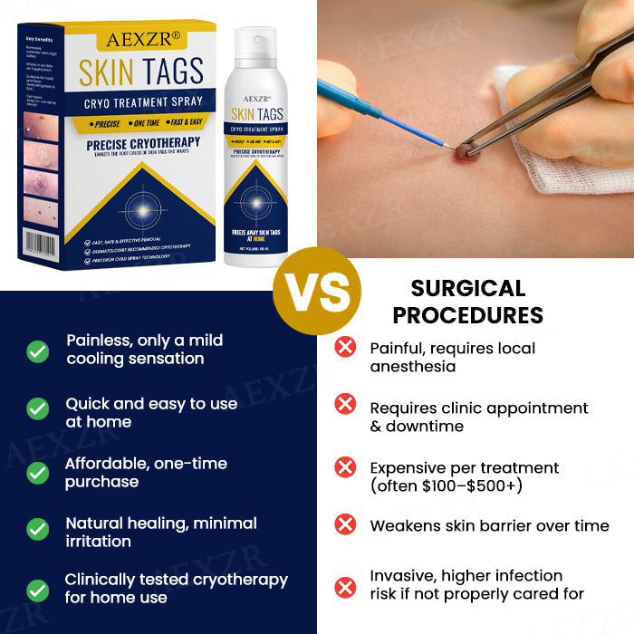 🌟 Official Store | AEXZR® Skin Tag Cryo Treatment Spray
