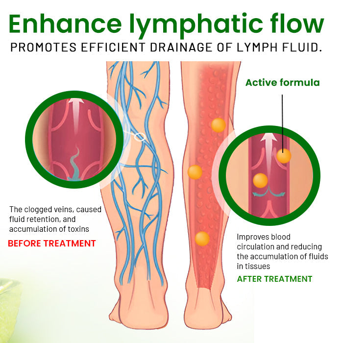 🌟 Official Store |AEXZR® FluidEase Leg Therapy Cream