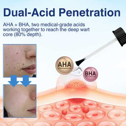 🌟 Official Store | Cvreoz® AHA Wart Removal Liquid