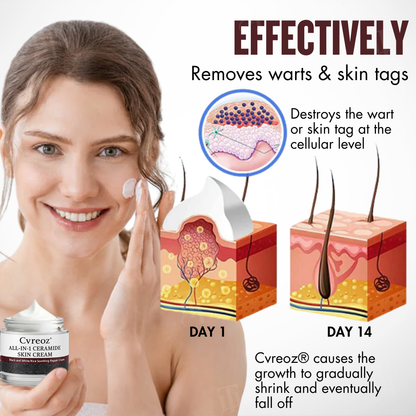 🌟 Official Store | Cvreoz® All-in-1 Ceramide Skin Cream