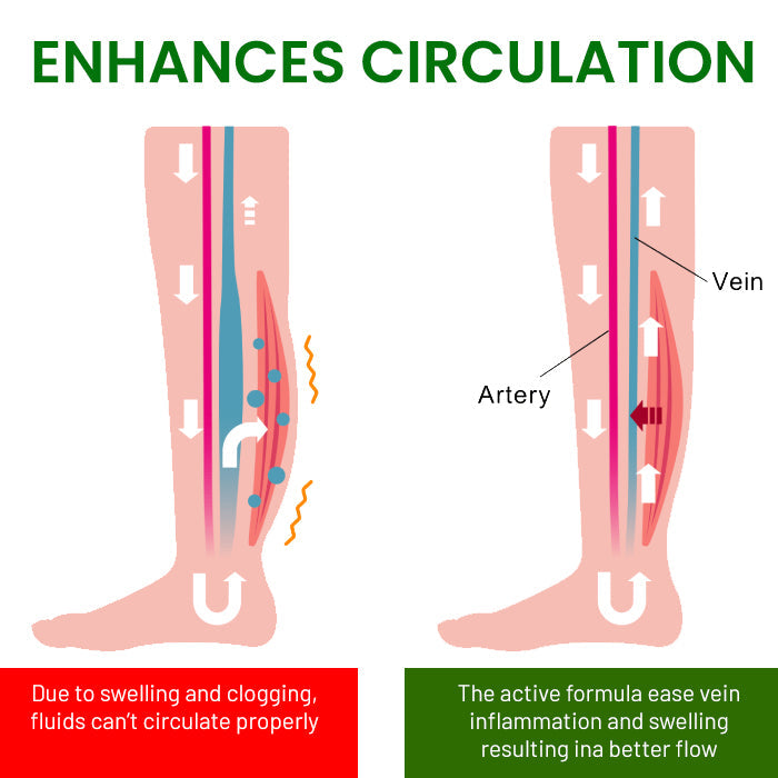 🌟 Official Store |AEXZR® FluidEase Leg Therapy Cream