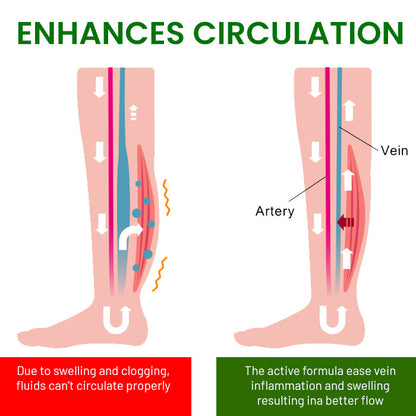 🌟 Official Store |AEXZR® FluidEase Leg Therapy Cream