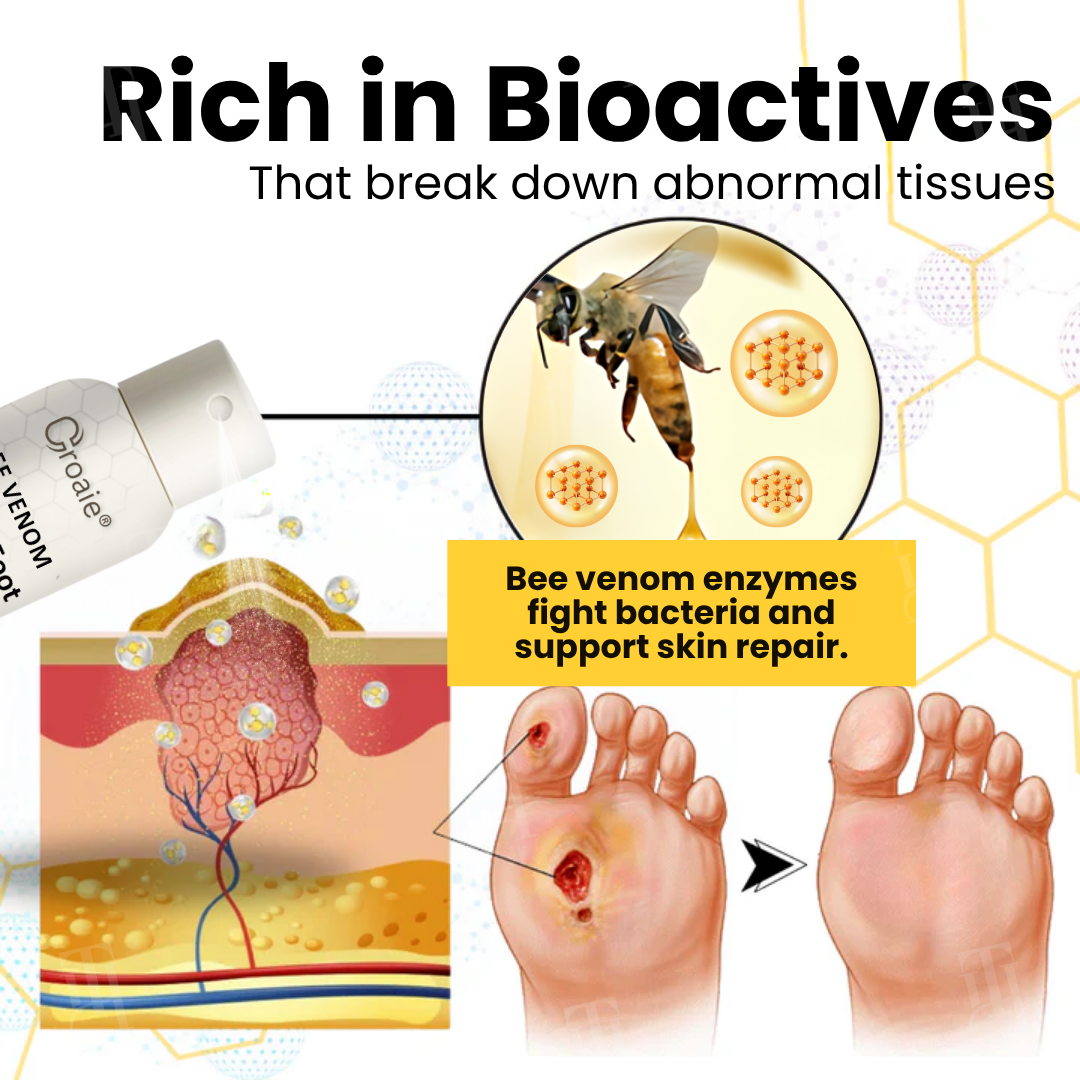 Croaie® Bee Venom Diabetic Foot Ulcer Spray