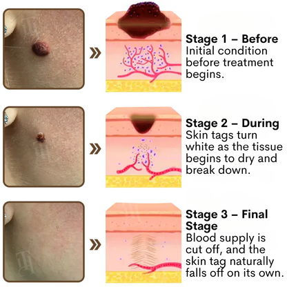 🌟 Official Store | Cvreoz® Pro-Repair Black Rice Concentrate Cream🧑‍⚕️MRHA Certified