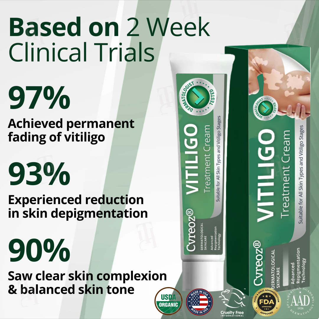 Cvreoz® Vitiligo Treatment Cream