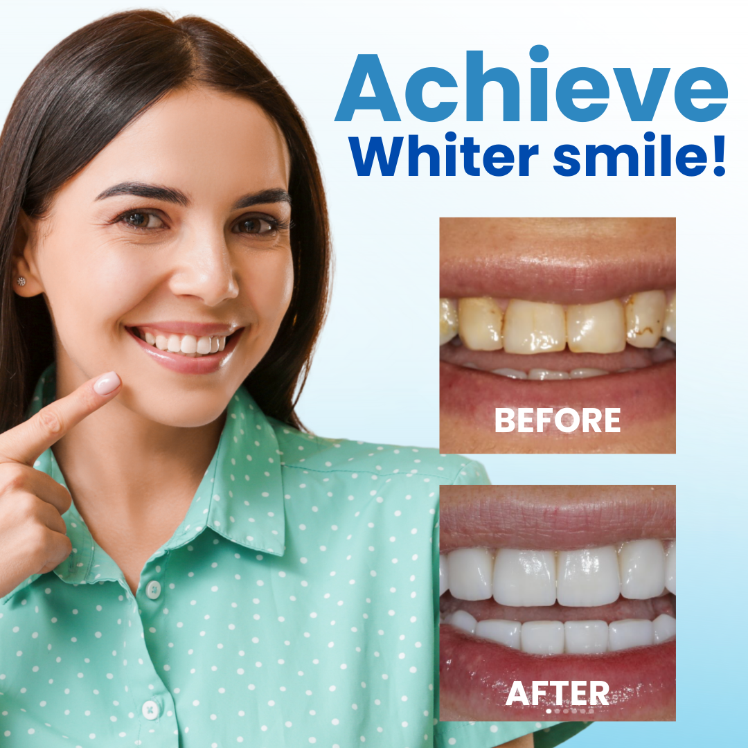 🦷 Fills Micro-Defects & Stops Sensitivity | AEXZR® Postbiotics Anti-Plaque Oral Serum