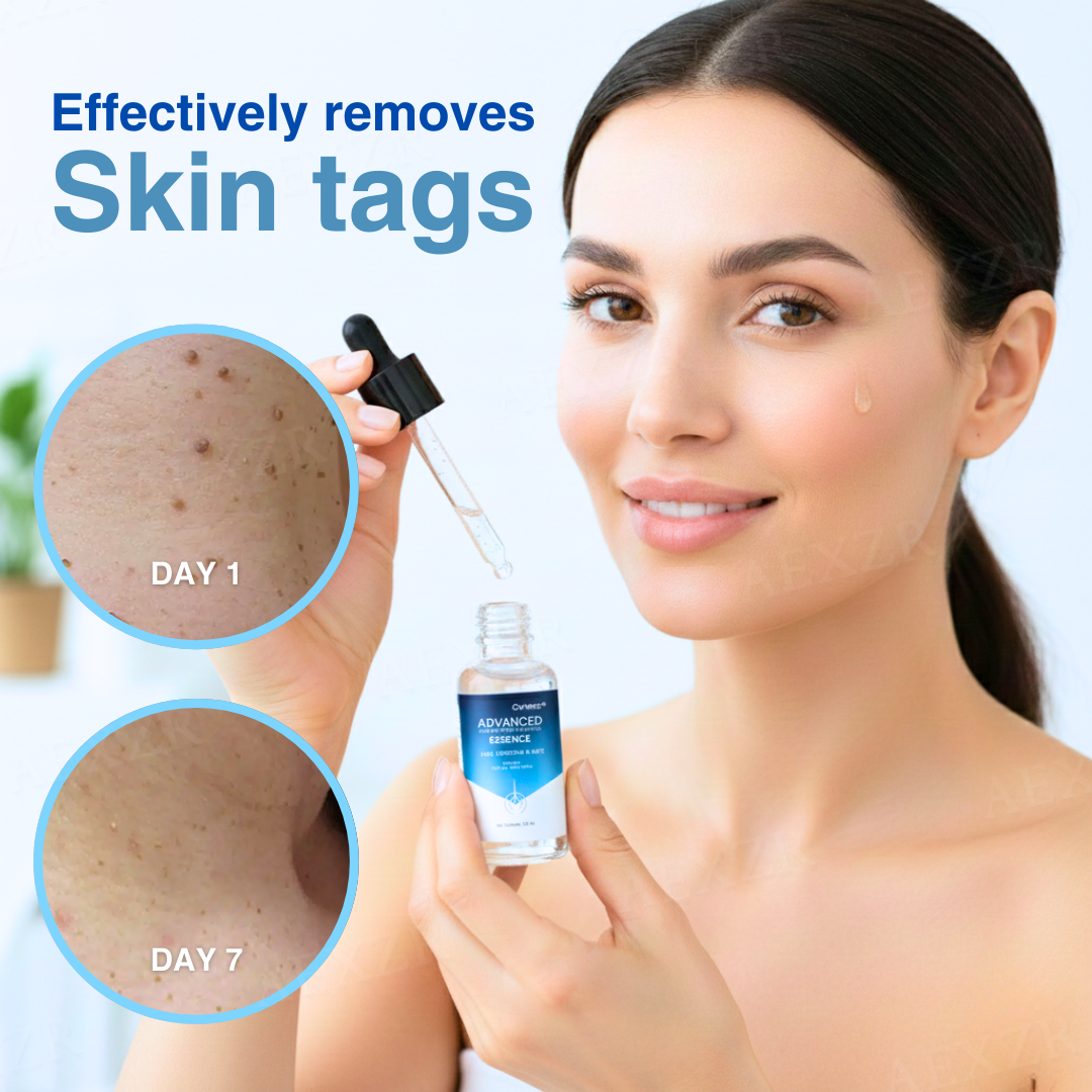 🌟 Official Store | Cvreoz® Advanced Skin Tag & Wart Removal Essence